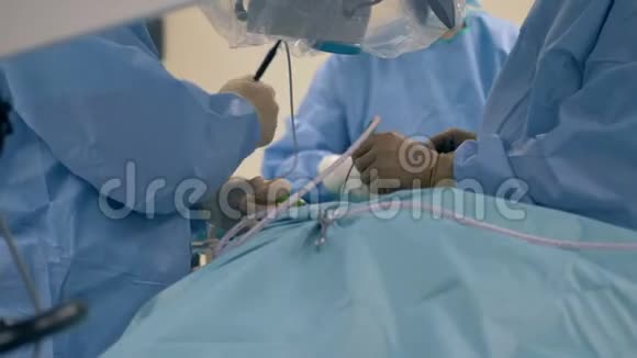 一组外科医生进行的手术视频的预览图
