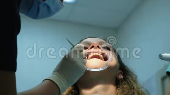 金属支架的安装与固定去看牙医矫正畸形治疗牙齿视频的预览图