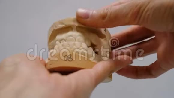 安装支架系统前牙齿的石膏模型颚开得滑稽靠近医生的手视频的预览图