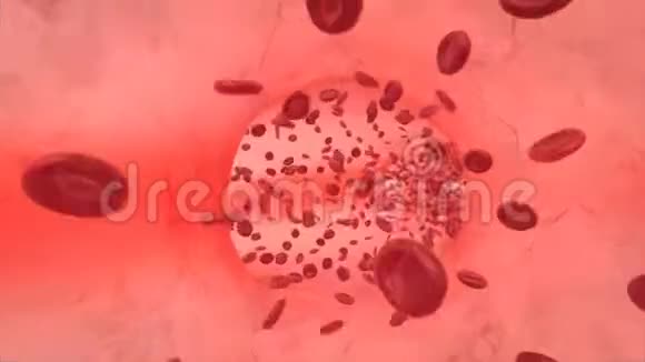 血细胞逆流而上视频的预览图