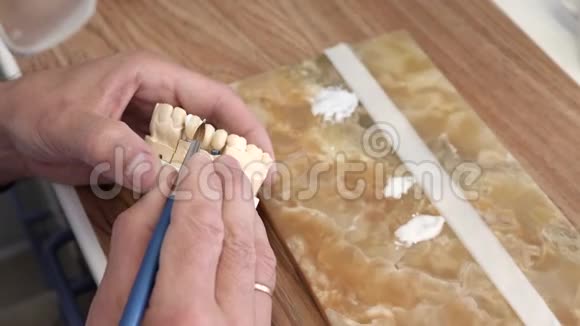 口腔科牙科技师在口腔科部分瓷冠上涂最后釉视频的预览图