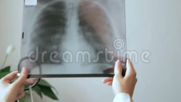 医务人员手持人体胸部光光照片视频的预览图