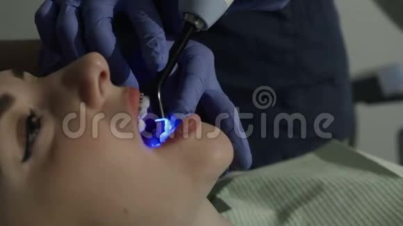 牙医他的医生治疗他病人的牙齿牙医把一个光聚合物封口视频的预览图