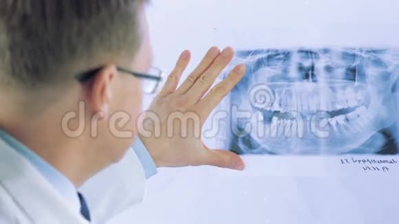 医生检查X射线视频的预览图