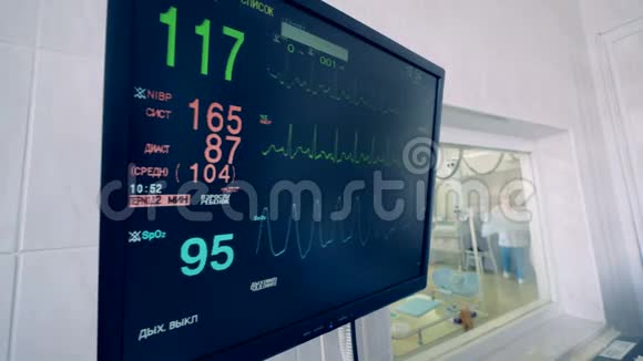 医疗设备在手术中显示病人的心率4公里视频的预览图