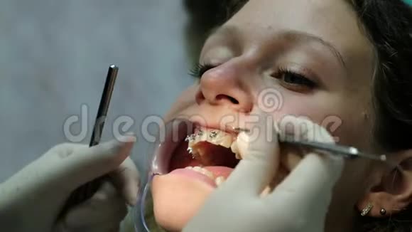 拜访牙医安装支架系统矫正错牙合正畸医生纠正视频的预览图