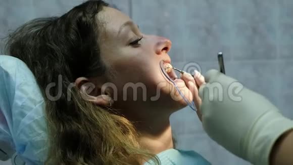 拜访牙医安装支架系统助理用牙科聚合紫外线灯发光视频的预览图