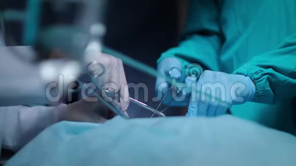外科医生在医疗手术中双手取下血塞保健视频的预览图