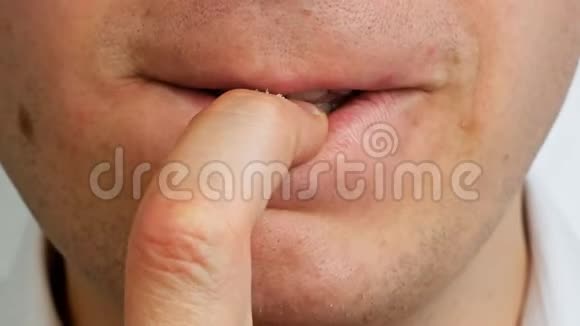 一个被牙齿咬着的人用手指咬着他的指甲闭上嘴视频的预览图