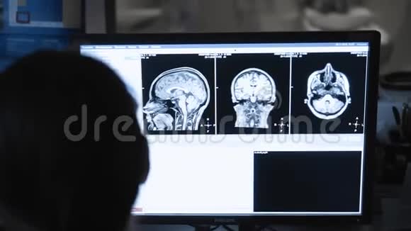核磁共振头部扫描过程高科技医学屏幕与脑扫描结果视频的预览图