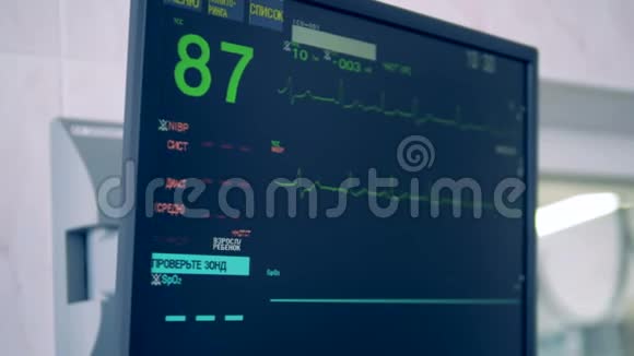 特殊监视器显示手术期间心脏状况4K视频的预览图