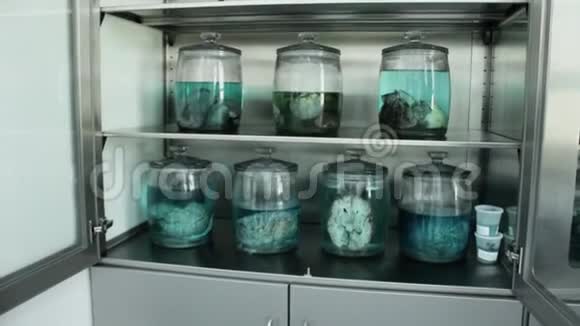 实验室里的人体器官人脑视频的预览图
