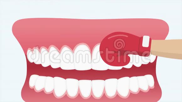 牙科创伤牙科2d动画视频的预览图