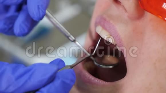 牙科医生在临床上为女性患者治疗牙齿视频的预览图