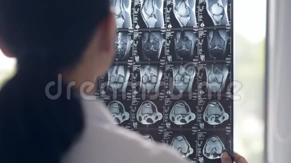 专业医生看X光扫描视频的预览图