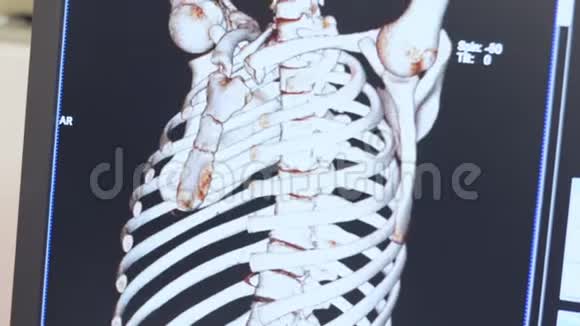 人体骨骼的磁共振成像视频的预览图