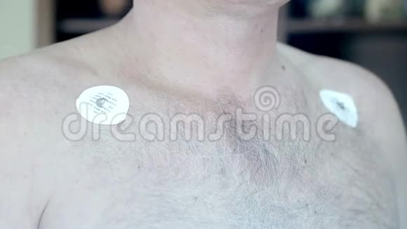 女性医生将电极贴在病人胸部以进行日常监测霍尔监测装置视频的预览图