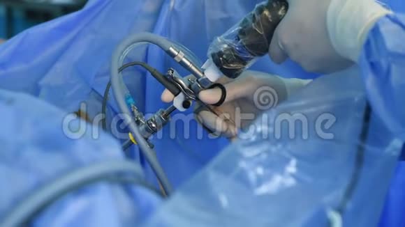 做腹腔镜手术的外科医生视频的预览图