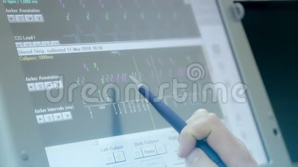 医生手写笔的特写用电脑屏幕检查病人心脏视频的预览图