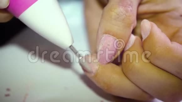 一个指甲丑陋的女孩用一台特殊的机器从指甲中去除指甲油为修指甲做准备关闭视频的预览图