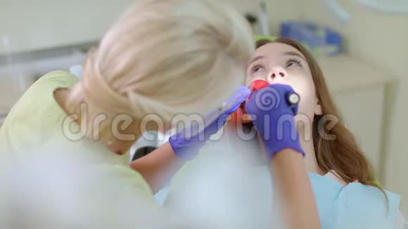 口腔内牙科聚合灯的牙科医生牙齿治疗视频的预览图