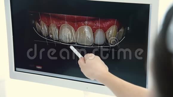 牙医给病人看了他牙齿的快照视频的预览图