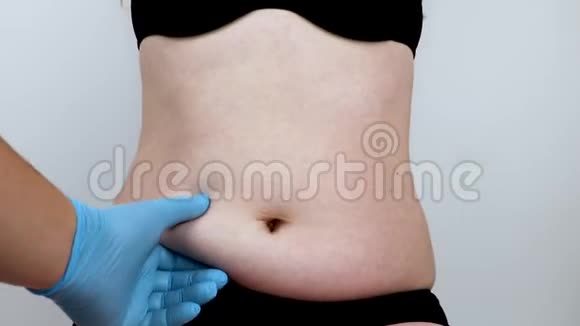腹部成形术和背成形术腹部吸脂和去除围裙在塑料浪涌接待处的病人视频的预览图