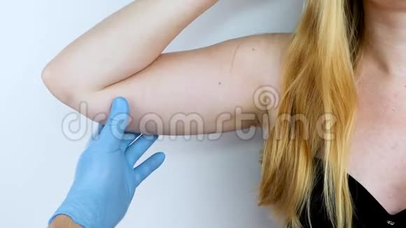一位整形外科医生正准备收紧手部皮肤腕管成形术塑料手臂手上挂着皮肤视频的预览图