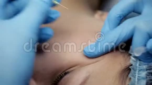 美容师用针扎在女孩脸上机械工作面清理程序视频的预览图