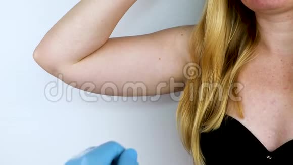一位整形外科医生正准备收紧手部皮肤腕管成形术塑料手臂手上挂着皮肤视频的预览图