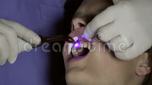 带着蓝光的牙医视频的预览图