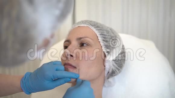 美容诊所美容师用手套在女性皮肤上进行面部老化注射肉毒杆菌胶原蛋白注射视频的预览图