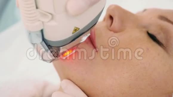 女人下巴上的除皱程序视频的预览图