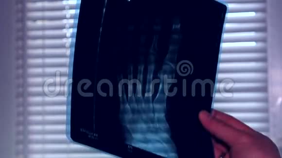 医生研究腿部X射线视频的预览图