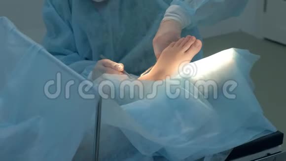 外科医生做手术去除脚踝湿瘤在医院双手特写视频的预览图