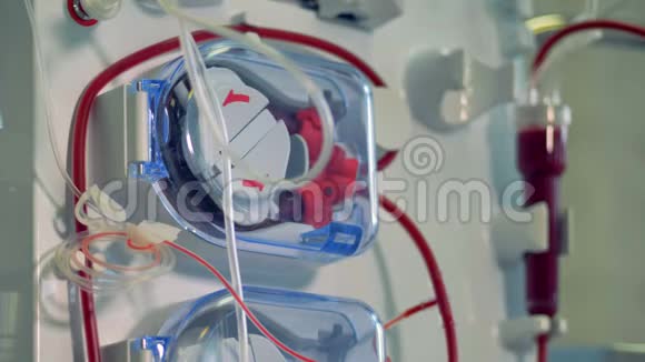 血液透析程序的现代医疗设备现代医疗设备理念视频的预览图