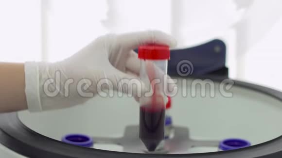 医生将血液放入离心式血浆置换的试管中视频的预览图