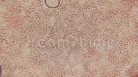 血细胞通道100x在卤素的作用下血小板在100倍放大时形成一个小通道视频的预览图