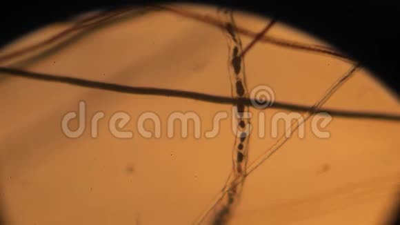 通过显微镜观察受损的毛发视频的预览图