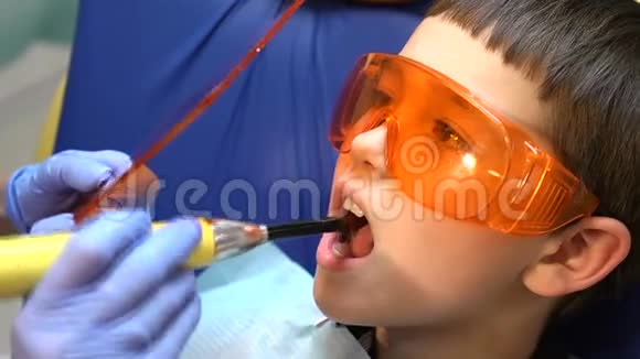 健康观念牙科诊所的一个男孩得到牙科治疗以填补牙齿的空洞牙齿修复及修复视频的预览图