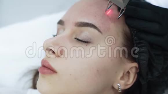 在激光面部剥离手术中将年轻女性的面部特写慢动作视频的预览图