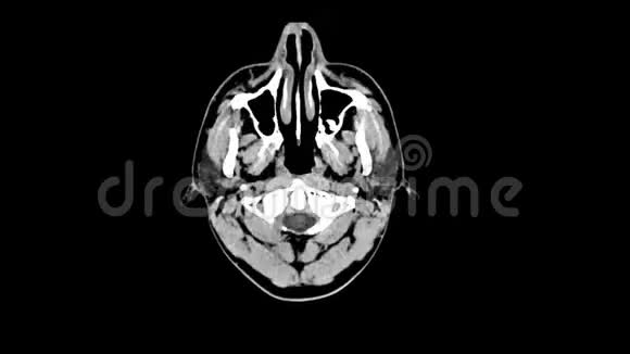 健康男性头部计算机医学断层扫描视频的预览图