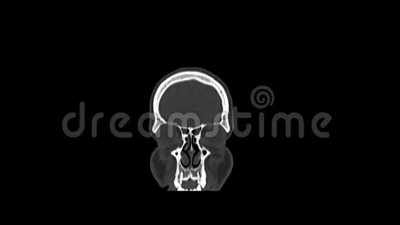 健康男性头部计算机医学断层扫描视频的预览图