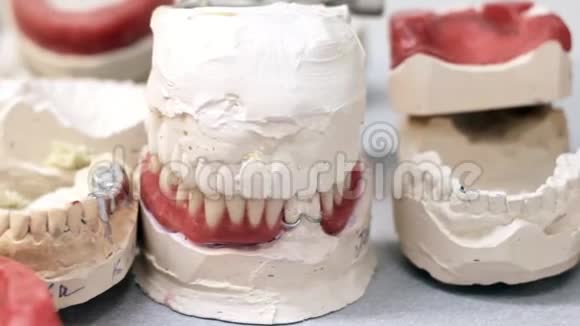 颌骨模型上的牙冠视频的预览图