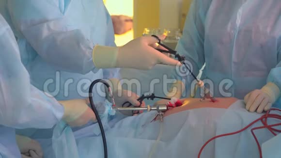 外科手术特写医生正在给一个男人做手术外科诊所视频的预览图