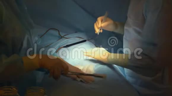 外科手术特写医生正在给一个男人做手术外科诊所视频的预览图