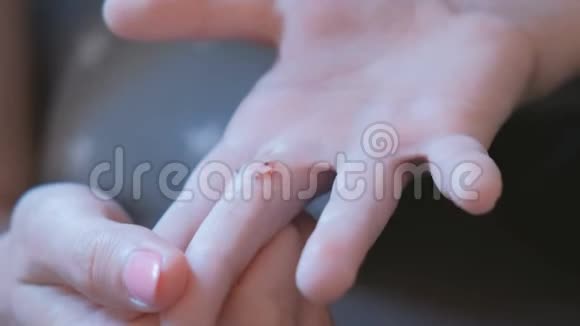 妈妈在孩子的手指上的伤口上涂了石膏视频的预览图