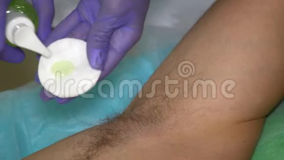手套中的美容师在加糖前给男性腋下消毒视频的预览图