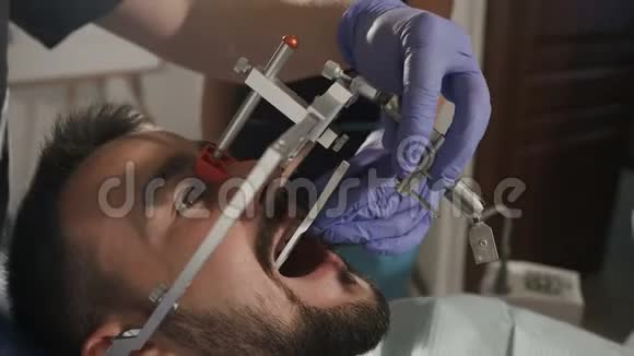 牙医用脸弓给病人做美容效果更好视频的预览图