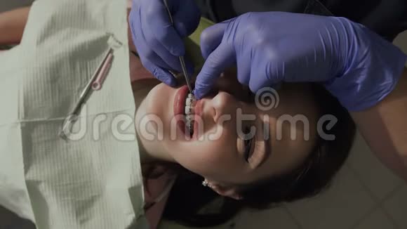 正畸医生在牙套上戴上弹性健康的牙齿病人的微笑很好视频的预览图